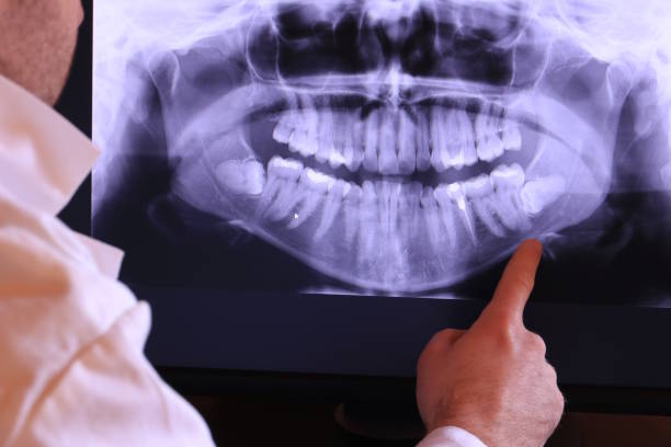 Best After-Hours Emergency Dentist in Bernardsville, NJ